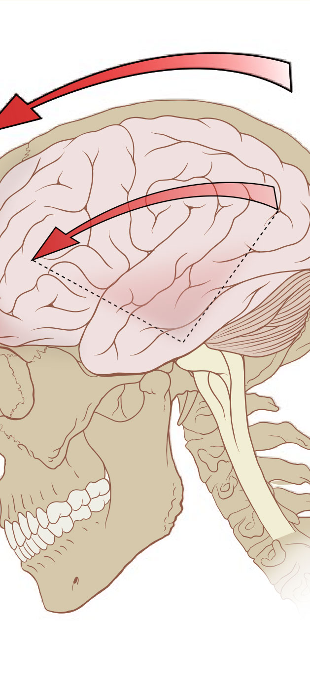 The Power of Brain-Based Adjustments - Hope Brain & Body Recovery Center